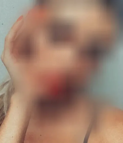 Chiara, 37